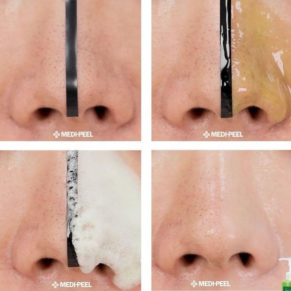 Зміцнююча киснева пінка для вмивання та очищення пор Medi - Peel Phyto CICA - Nol B 5 AHA BHA Vitamin Caming O2, 150 мл MP005 фото